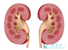 ����ת����ʲô֢״������Щ����ҩ�ԣ�