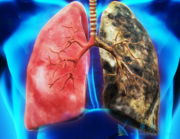 �ΰ�����