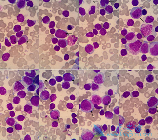 ������Ѫ��