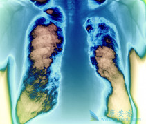 �������������Ƽ�Ƥ��Ч����ô����