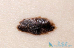 ���Ժ�������ʲô֢״���֣�����Щ���Ʒ�����