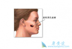 �����������Ƶĺ�ɫ���������������ж�ã�