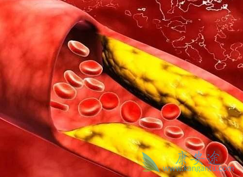 ���������쳣�ۺ�֢