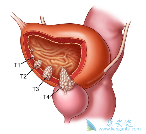 ���װ�����