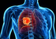 �ΰ������öȷ����ȵ��������̿��ӳ��޶񻯴����