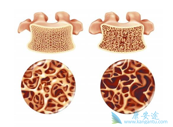 双磷酸盐 双磷酸盐