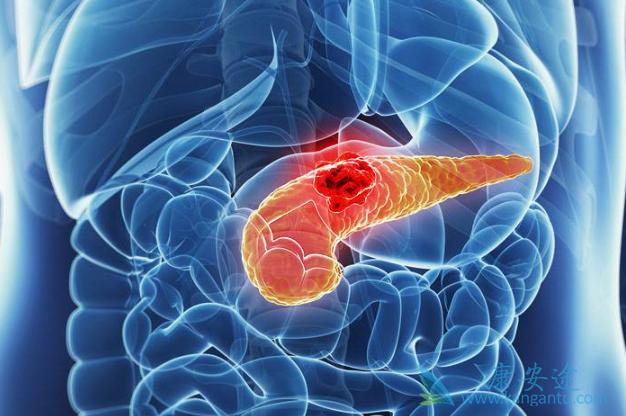 胰腺癌治疗 胰腺癌治疗