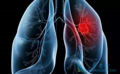 TKI�����ڷΰ��¸�������������������Щ���⣿