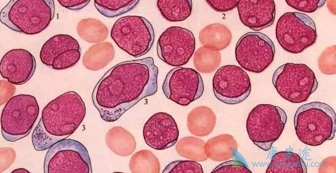 ���������쳣�ۺ�֢