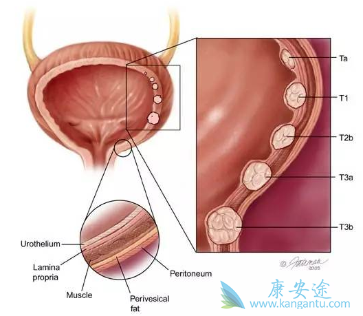 ������·��Ƥ��