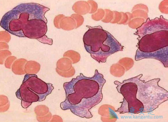 ��������ת������Щ֢״������жϹ�ת�ƣ�