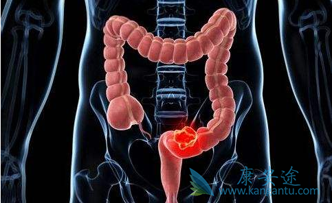 ��ֱ����