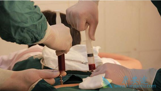 ������ֲ