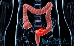 ߻��������Ϊ���ڽ�ֱ������������ҩ