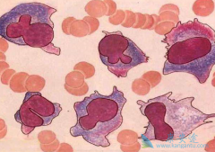 CAR-T�Ʒ��ڶ෢�Թ�����������ȡ����������Ч