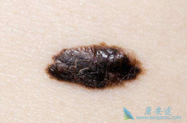 ��ɫ��������