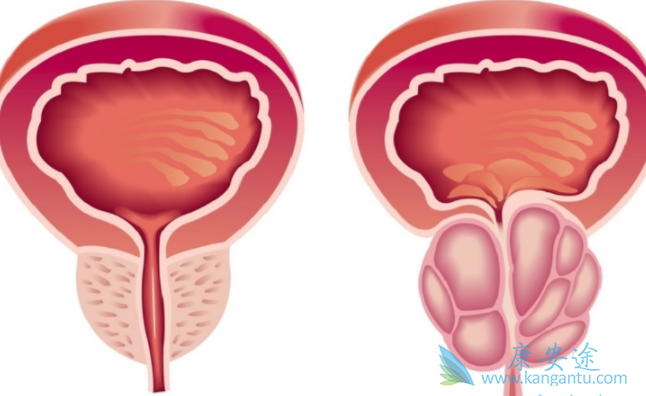 ǰ���ٰ�����